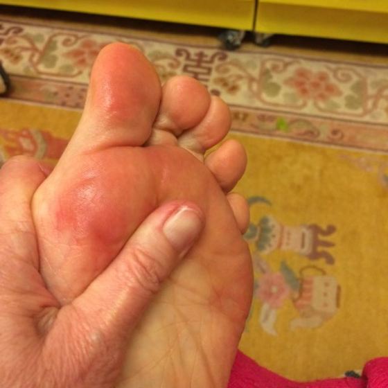 massera fot med sesamolja